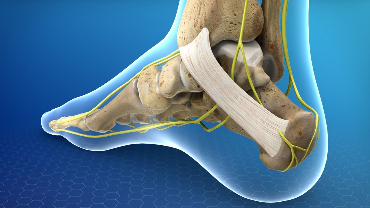 Tarsal Tunel Sendromu1